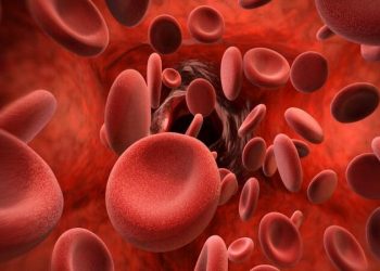 अकोला जिल्ह्यात आढळले सिकलसेलचे नवे 142 बाधित रुग्ण