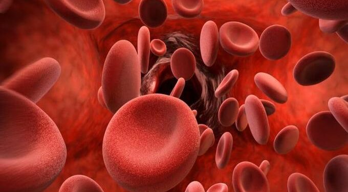 अकोला जिल्ह्यात आढळले सिकलसेलचे नवे 142 बाधित रुग्ण