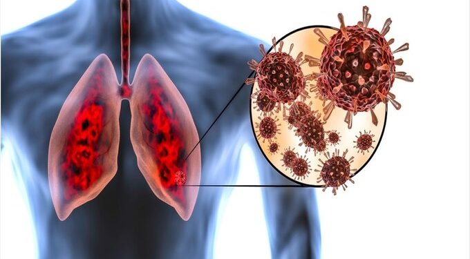 दुसर्या लाटेतील कोरोना वेगाने करीत आहे फुफ्फुसांचे नुकसान
