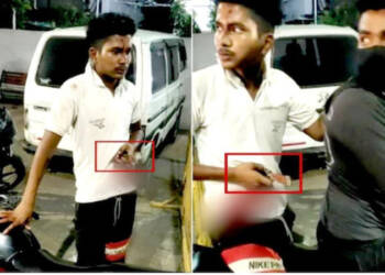 मित्राकडून हत्येचा प्रयत्न; पोटात अडकलेला चाकू घेऊन तरुण पोहोचला पोलीस ठाण्यात