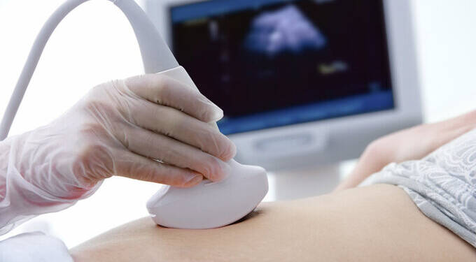 sonography and abortion centers