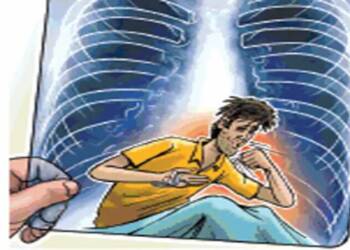 क्षयरुग्णांनी आहार भत्त्यासाठी बँक खात्याची अद्यावत माहीती द्यावी — डॉ. अस्मिता पाठक