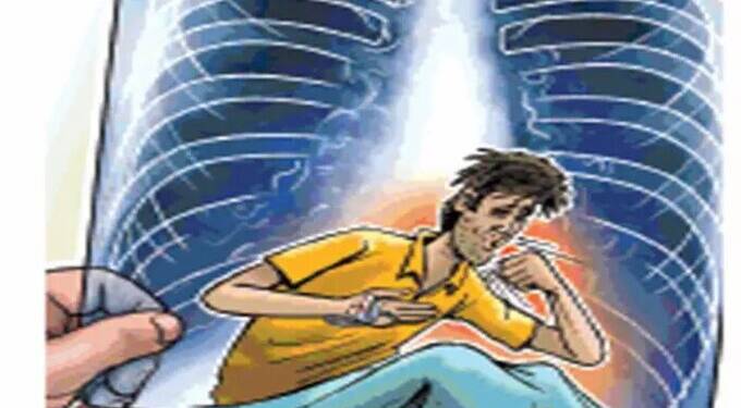 क्षयरुग्णांनी आहार भत्त्यासाठी बँक खात्याची अद्यावत माहीती द्यावी — डॉ. अस्मिता पाठक